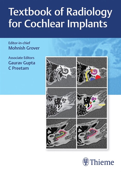 Textbook of Radiology for Cochlear Implants (Hardcover)