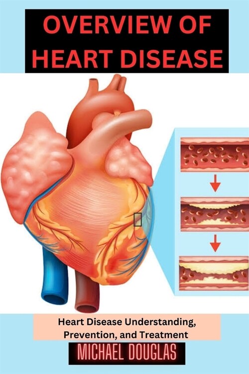 Overview of heart disease: Heart Disease Understanding, Prevention, and Treatment (Paperback)