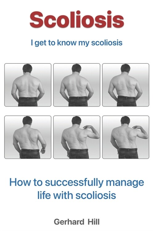 Scoliosis: Im getting to know my scoliosis (Paperback)