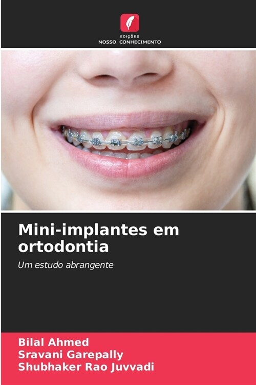 Mini-implantes em ortodontia (Paperback)