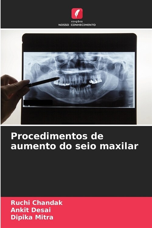 Procedimentos de aumento do seio maxilar (Paperback)