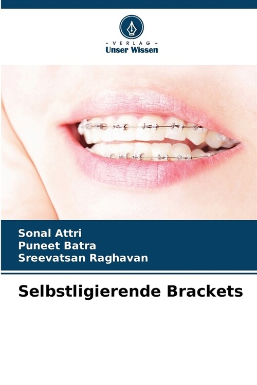 Selbstligierende Brackets (Paperback)