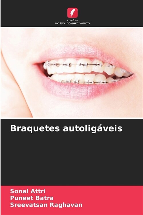 Braquetes autolig?eis (Paperback)