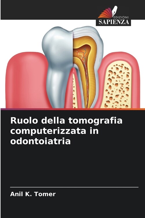 Ruolo della tomografia computerizzata in odontoiatria (Paperback)