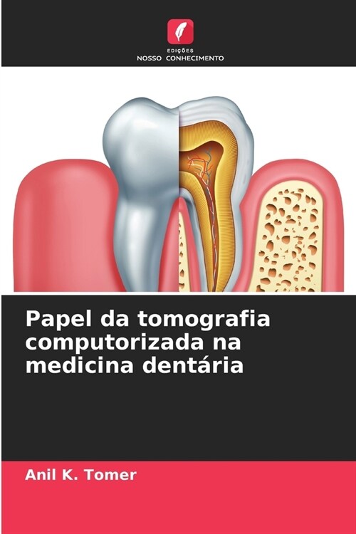 Papel da tomografia computorizada na medicina dent?ia (Paperback)