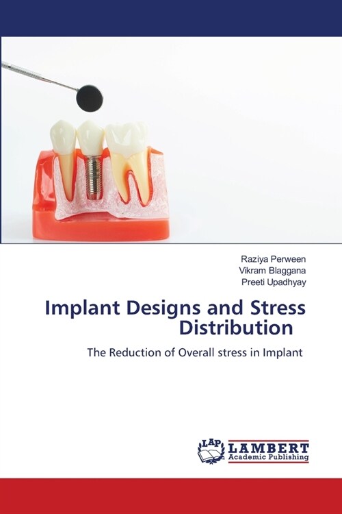 Implant Designs and Stress Distribution (Paperback)
