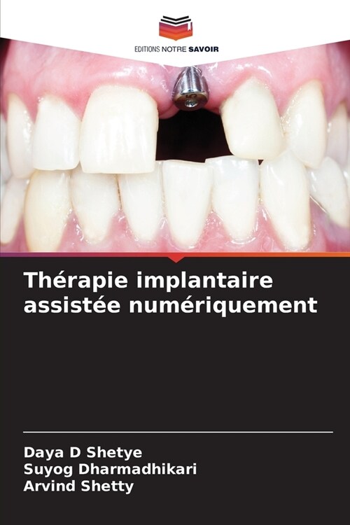 Th?apie implantaire assist? num?iquement (Paperback)