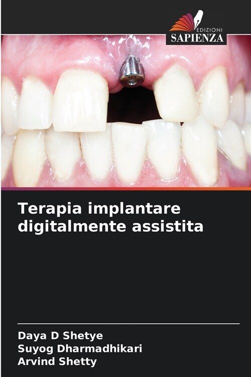 Terapia implantare digitalmente assistita (Paperback)