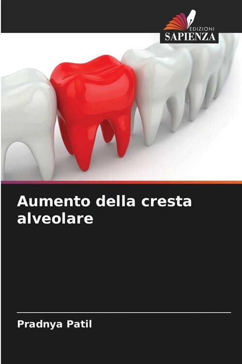 Aumento della cresta alveolare (Paperback)