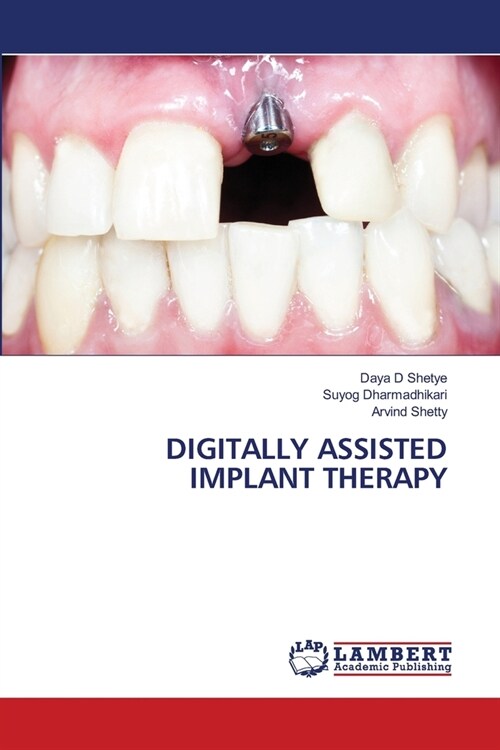 Digitally Assisted Implant Therapy (Paperback)