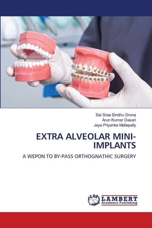 Extra Alveolar Mini-Implants (Paperback)