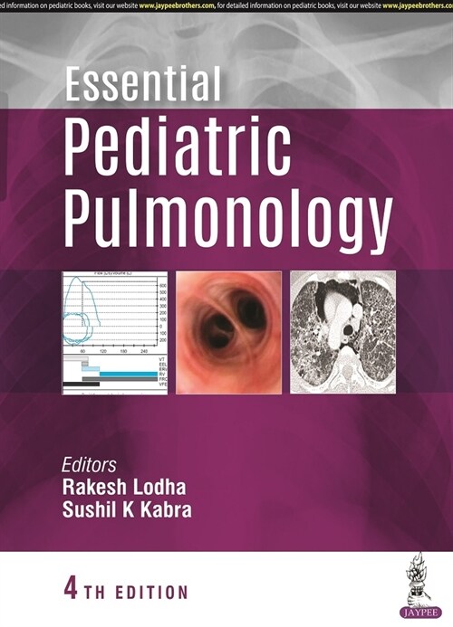 Essential Pediatric Pulmonology (Paperback, 4 Revised edition)