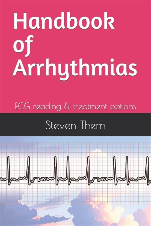 Handbook of Arrhythmias: ECG reading & treatment options (Paperback)