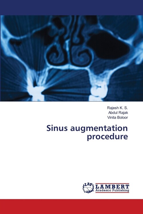 Sinus augmentation procedure (Paperback)