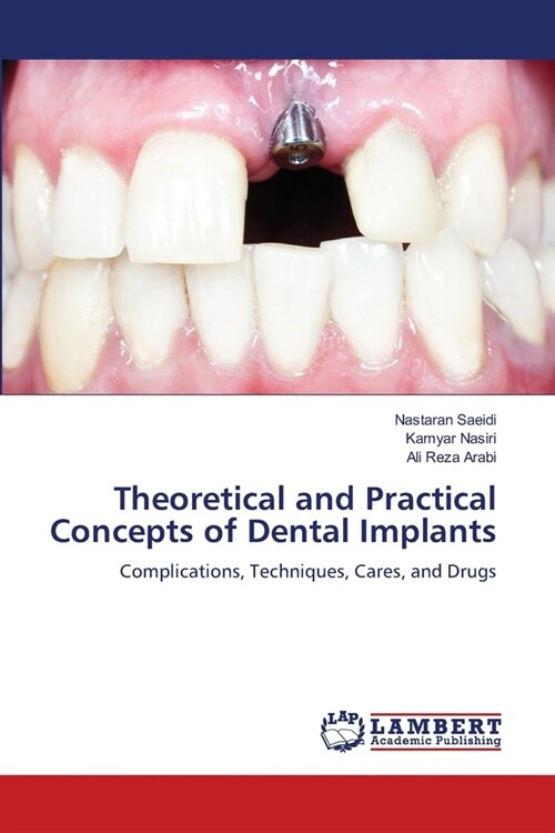 Theoretical and Practical Concepts of Dental Implants (Paperback)