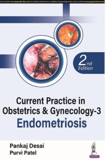 Current Practice in Obstetrics & Gynecology - 3 : Endometriosis (Paperback, 2 Revised edition)