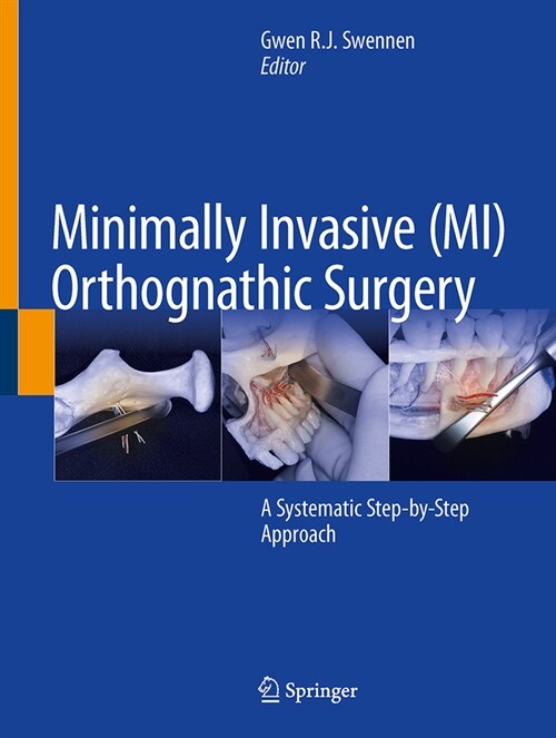 Minimally Invasive (Mi) Orthognathic Surgery: A Systematic Step-By-Step Approach (Hardcover, 2023)