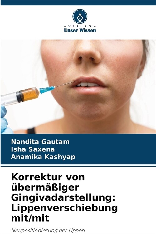 Korrektur von ?erm癌iger Gingivadarstellung: Lippenverschiebung mit/mit (Paperback)