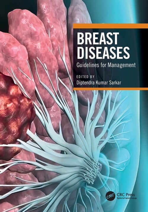 Breast Diseases : Guidelines for Management (Paperback)