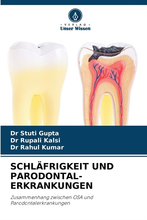 Schl?rigkeit Und Parodontal- Erkrankungen (Paperback)