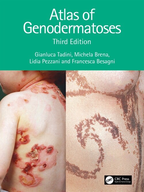 Atlas of Genodermatoses (Paperback, 3 ed)