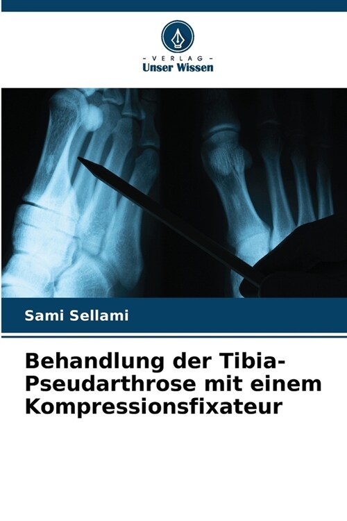 Behandlung der Tibia-Pseudarthrose mit einem Kompressionsfixateur (Paperback)