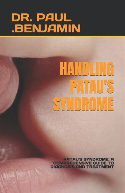 Handling Pataus Syndrome: Pataus Syndrome: A Comprehensive Guide to Diagnosis and Treatment (Paperback)