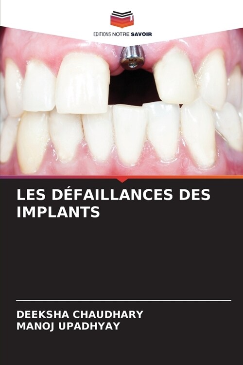 Les D?aillances Des Implants (Paperback)