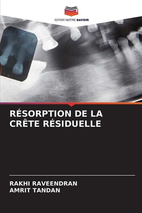 R?orption de la Cr?e R?iduelle (Paperback)