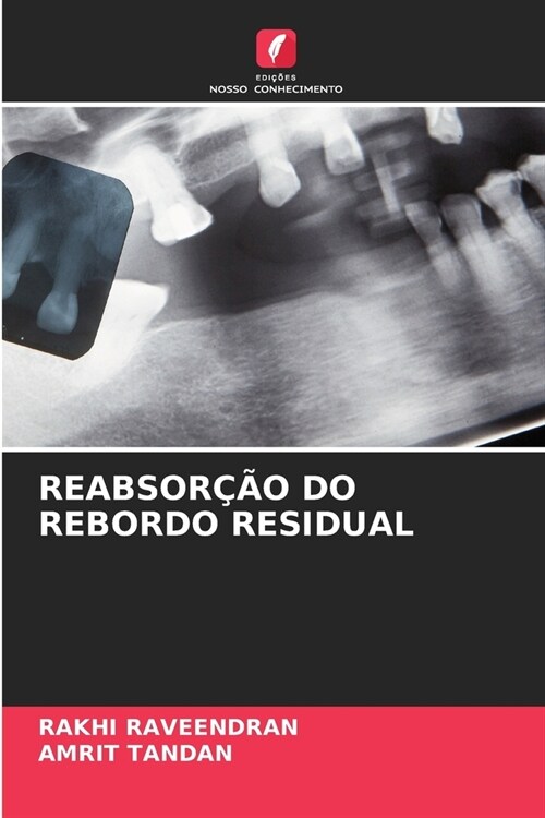 Reabsor豫o Do Rebordo Residual (Paperback)