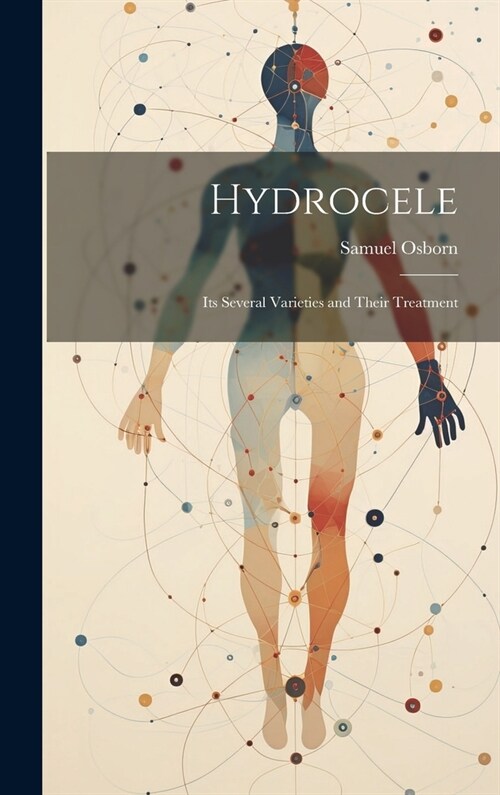 Hydrocele: Its Several Varieties and Their Treatment (Hardcover)