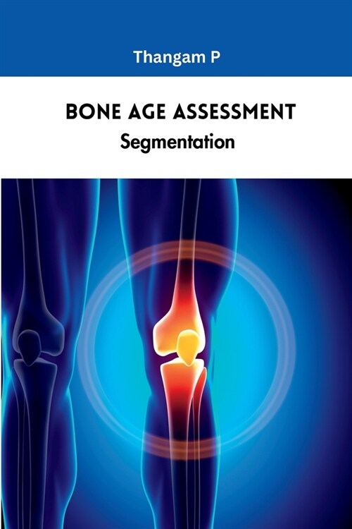 Bone Age Assessment Segmentation (Paperback)