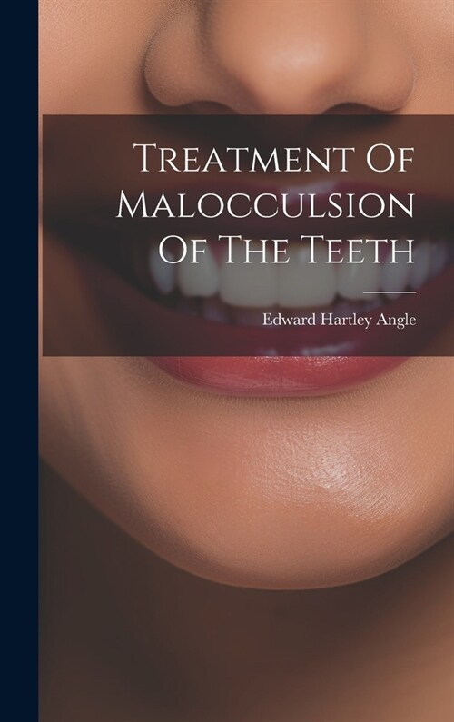 Treatment Of Malocculsion Of The Teeth (Hardcover)