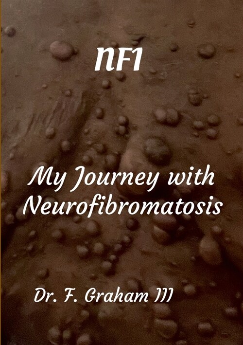 Nf1: Life With Neurofibromatosis (Paperback)