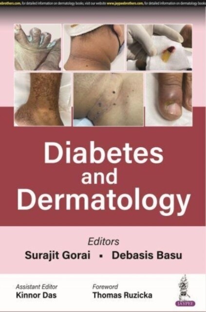 Diabetes and Dermatology (Paperback)