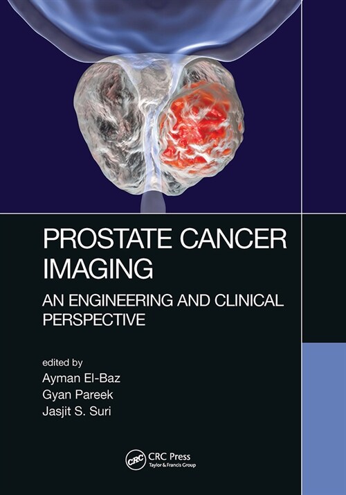 Prostate Cancer Imaging : An Engineering and Clinical Perspective (Paperback)