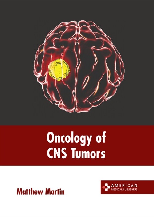 Oncology of CNS Tumors (Hardcover)