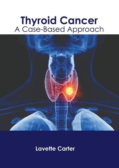 Thyroid Cancer: A Case-Based Approach (Hardcover)