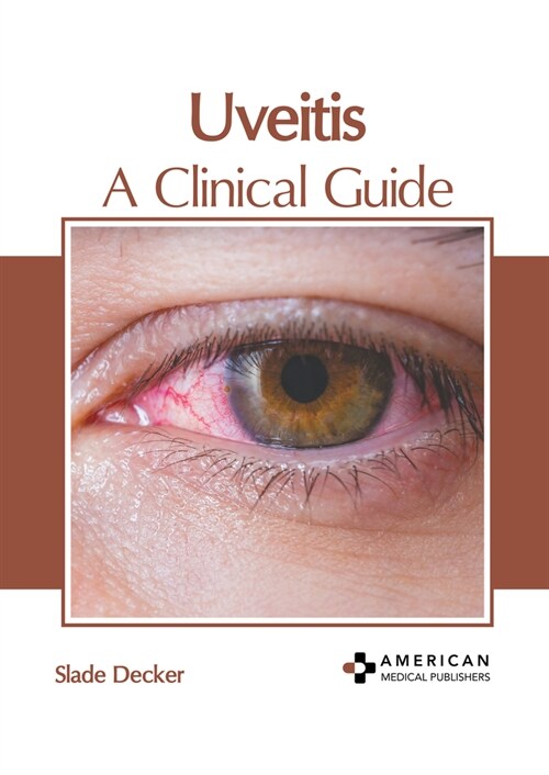 Uveitis: A Clinical Guide (Hardcover)