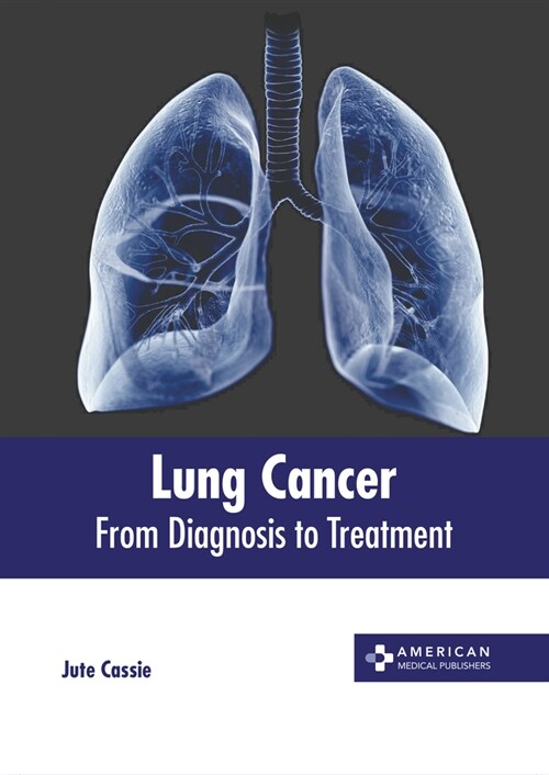 Lung Cancer: From Diagnosis to Treatment (Hardcover)