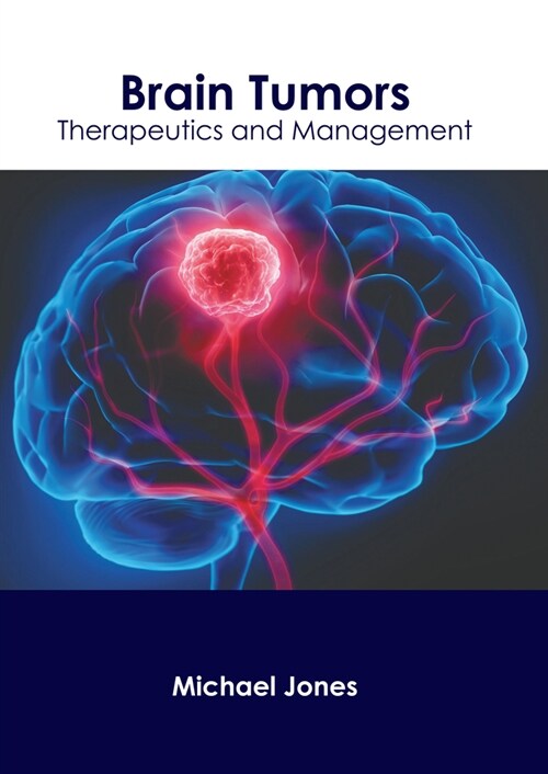 Brain Tumors: Therapeutics and Management (Hardcover)