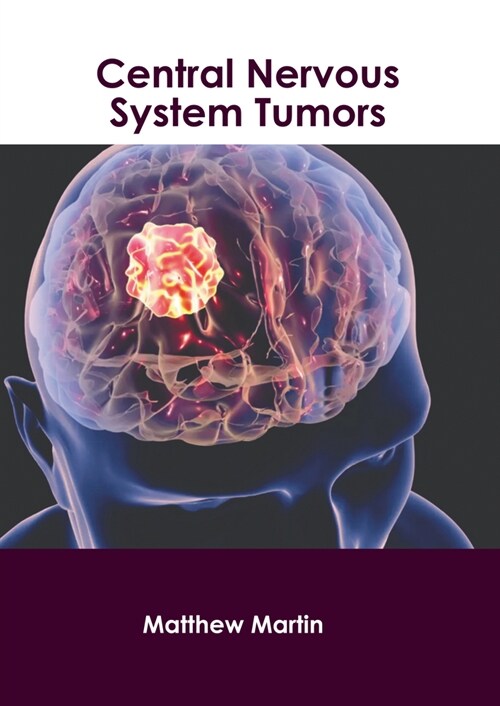 Central Nervous System Tumors (Hardcover)