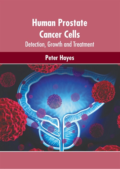 Human Prostate Cancer Cells: Detection, Growth and Treatment (Hardcover)