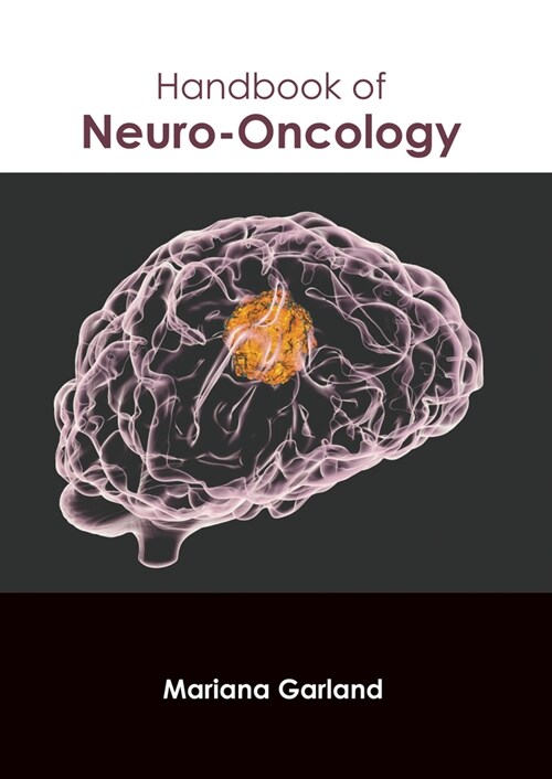 Handbook of Neuro-Oncology (Hardcover)