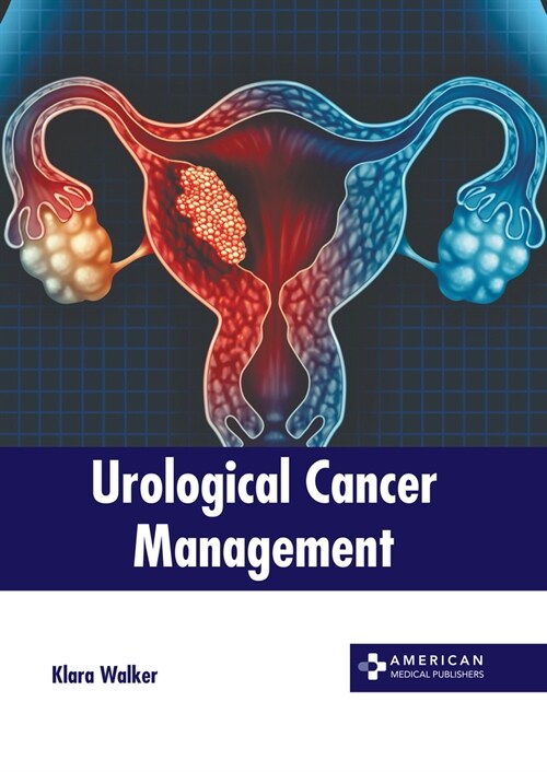 Urological Cancer Management (Hardcover)