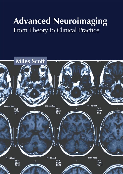Advanced Neuroimaging: From Theory to Clinical Practice (Hardcover)