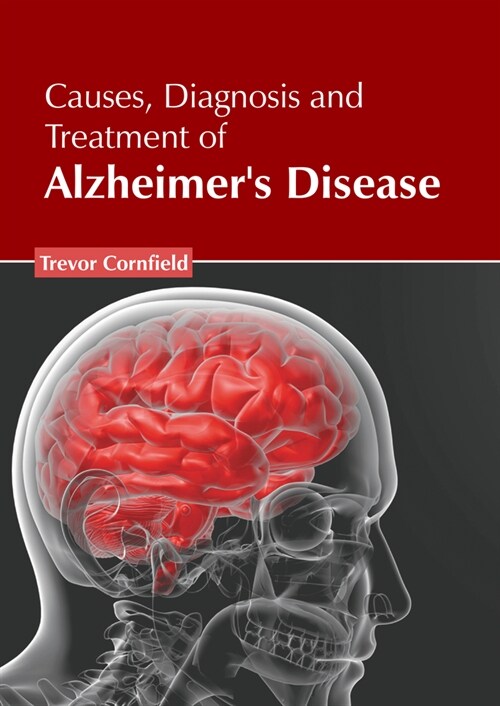 Causes, Diagnosis and Treatment of Alzheimers Disease (Hardcover)