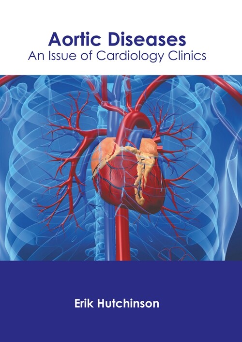 Aortic Diseases: An Issue of Cardiology Clinics (Hardcover)