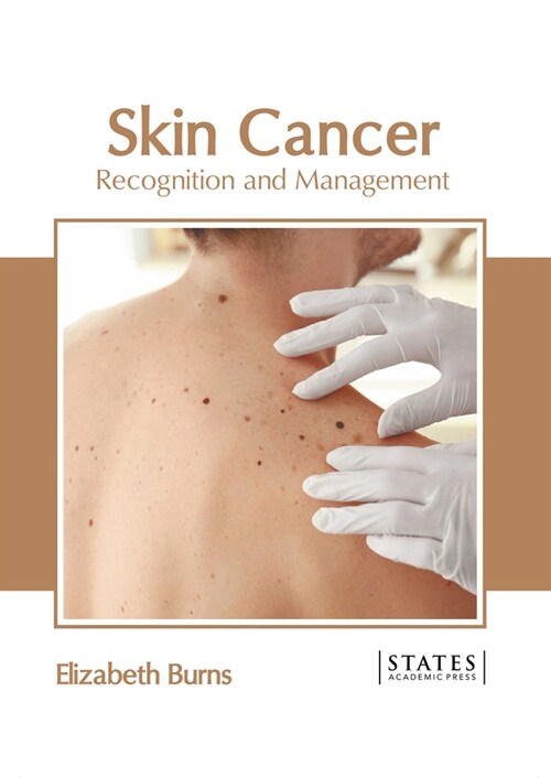 Skin Cancer: Recognition and Management (Hardcover)