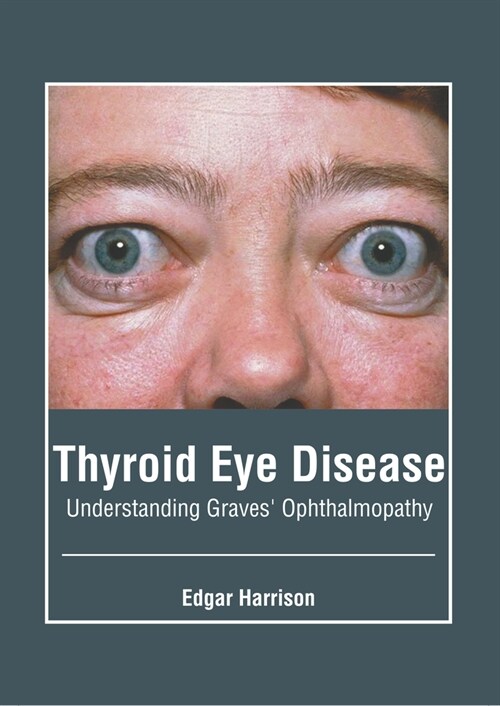 Thyroid Eye Disease: Understanding Graves Ophthalmopathy (Hardcover)